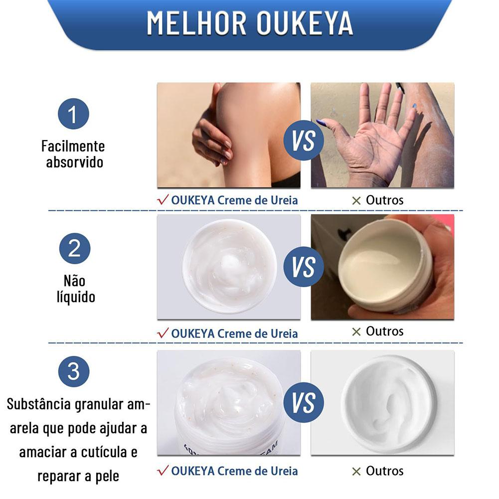 Крем с мочевиной 40% увлажняющ – обзор и цена Urea Foot Cream