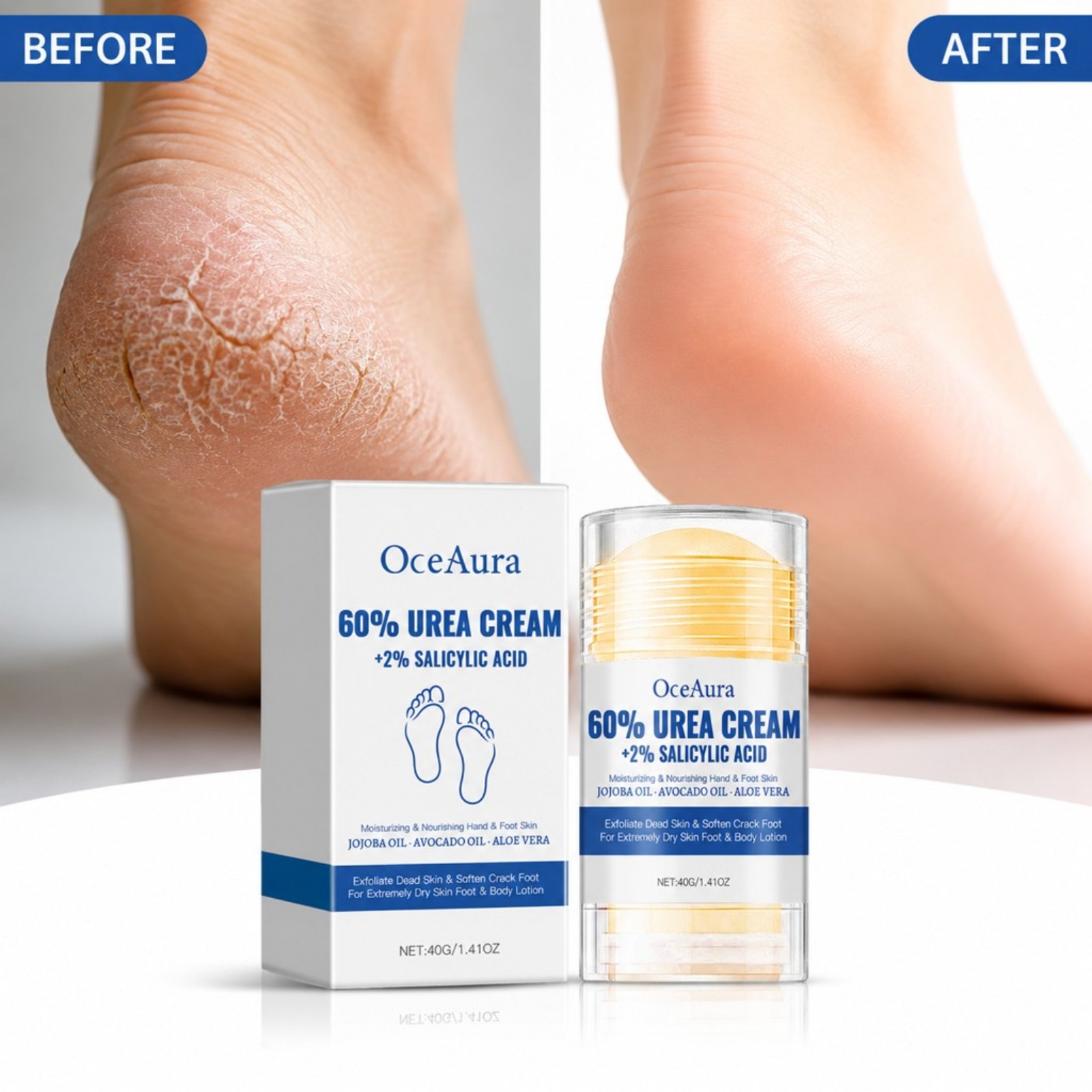 Крем-стик для ухода за ногами  – обзор и цена Urea Foot Cream