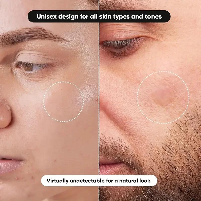 360 шт./кор. пластыри от прыще – обзор и цена Face Oil