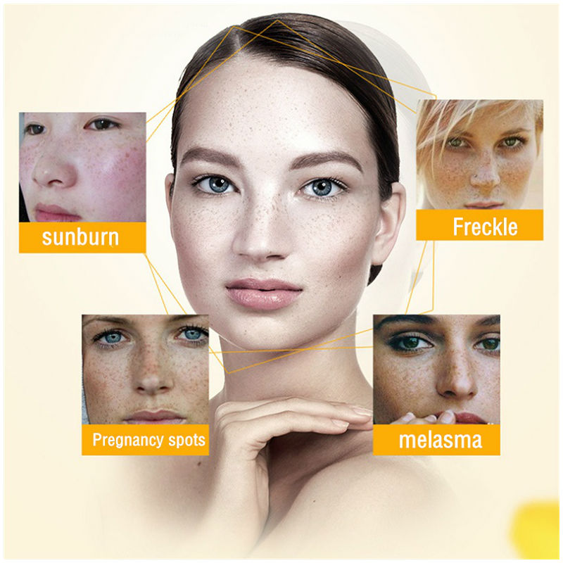 Dimollaure Отбеливающий крем о – обзор и цена Retinol Cream