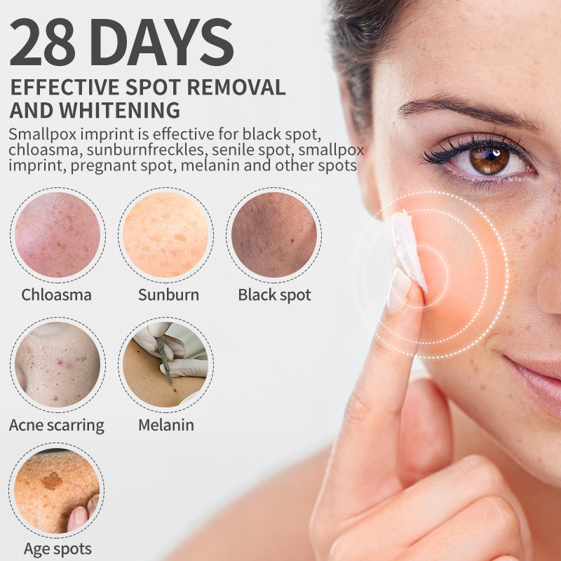Dimollaure Отбеливающий крем о – обзор и цена Retinol Cream