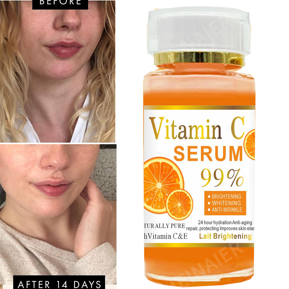 Антивозрастная отбеливающая сы – обзор и цена Vitamin C Serum