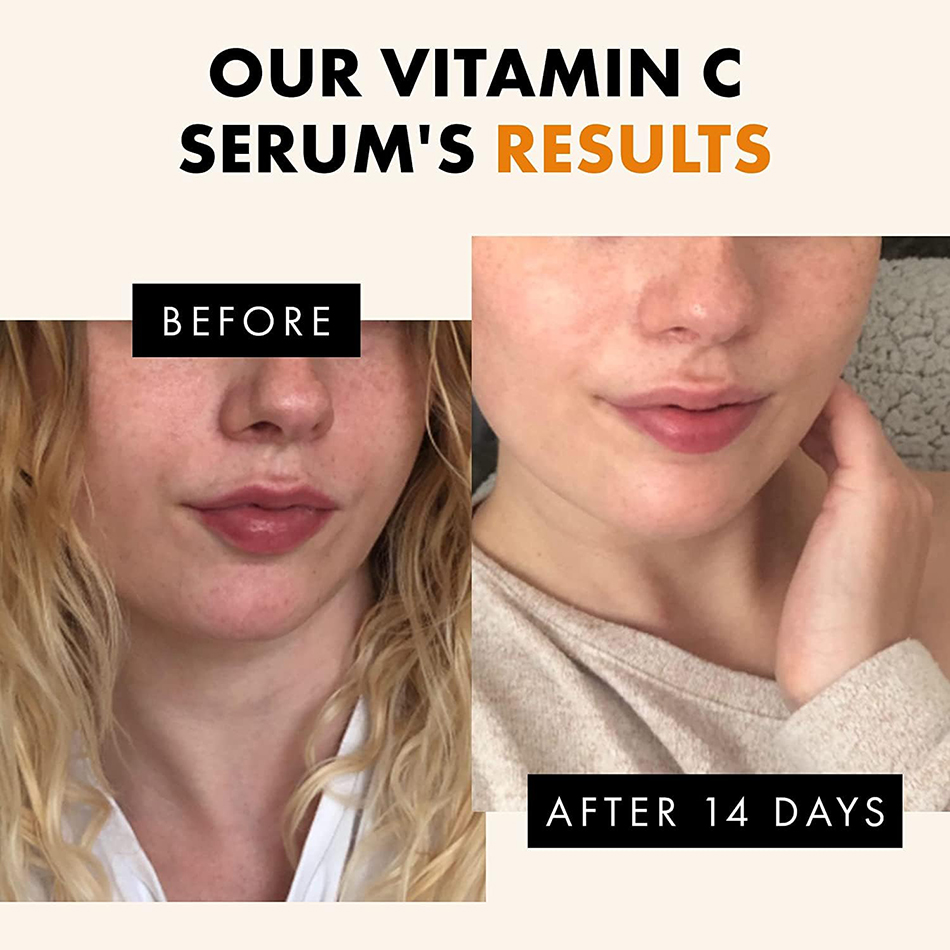 Антивозрастная отбеливающая сы – обзор и цена Vitamin C Serum
